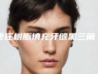 枣庄树脂填充牙缝黑三角整形手术术后效果好不好