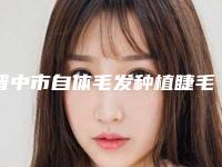 晋中市自体毛发种植睫毛医生在榜清单前十都是哪位-晋中市自体毛发种植睫毛整形医生