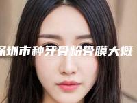 深圳市种牙骨粉骨膜大概多少钱-深圳市种牙骨粉骨膜医院在榜名单前十强人气高的有哪些